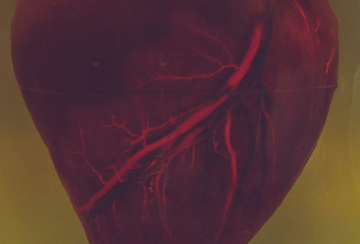 A human heart suspended in liquid